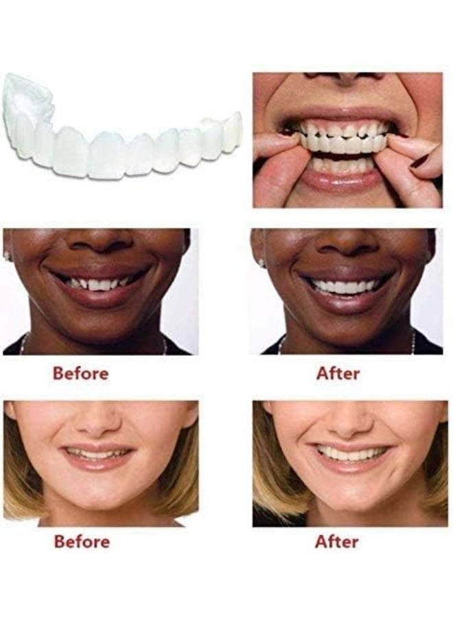Generic TBBA 4PCS/Set Upper Lower Teeth Magic Teeth Temporary Cosmetic Teeth, for Comfort Fit, Snap On, Flex Fits Prevently Quick Dentures  - Image 3