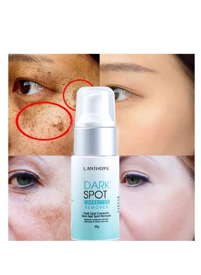 Lanthome 30g Dark Spot Corrector Cream – Professional Grade Face & Body Treatment for Hyperpigmentation | Works on All Skin Types & Tones (Men & Women) - Image 5