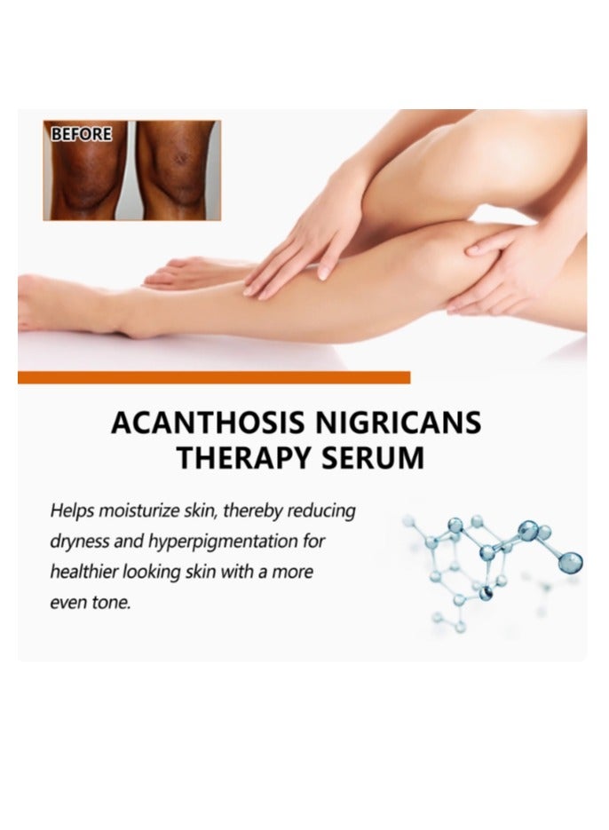 إيلهو مزيل الميلانين والبقع الداكنة، مصل تفتيح متطور، مصل تفتيح البشرة المتقدم لإزالة الميلانين وإزالة البقع الداكنة، جوهر إصلاح الأكانثوباناكس الأسود - Image 3