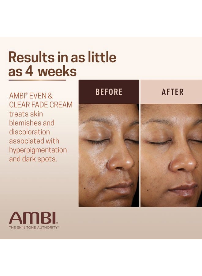 ambi كريم تفتيح حتى وواضح، خالي من الهيدروكينون، علاج فرط التصبغ، مصحح للبقع الداكنة، نتائج في أقل من 4 أسابيع، نياسيناميد، صبار، فيتامين سي، 1 أونصة سائلة - Image 4