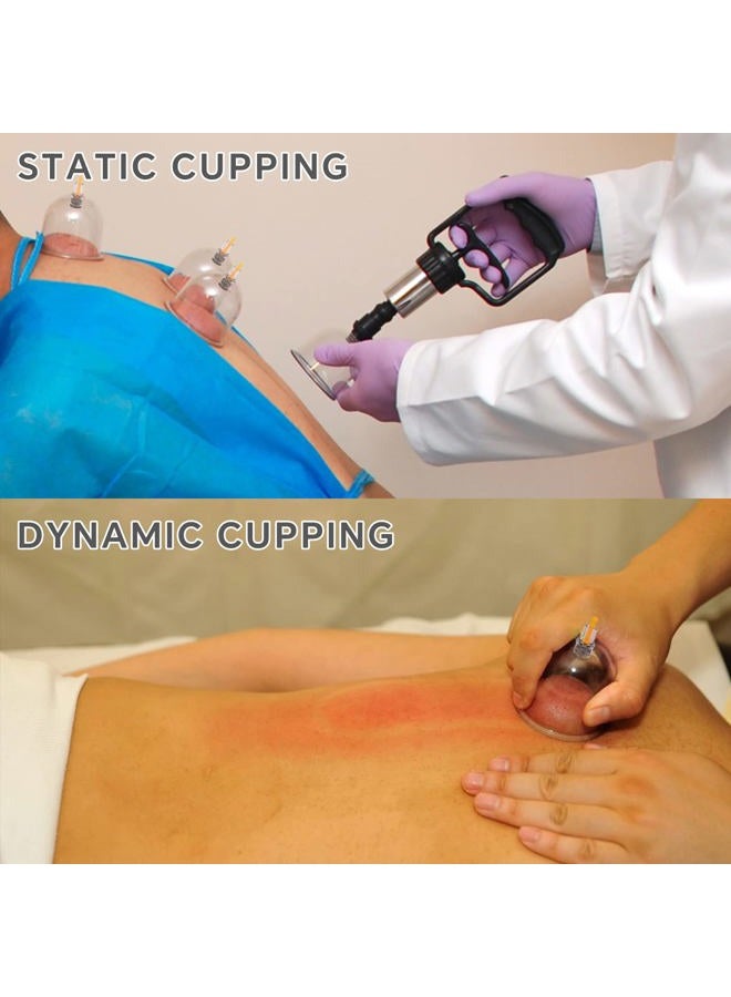 AIKOTOO Cupping Set Massage Therapy Cups Cupping Kit for Body Cellulite 24 Suction Cups - Image 5