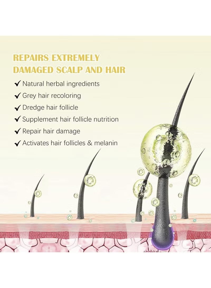 سيفودون 5٪ Minoxidil نمو الشعر مصل مجموعة مع Derma Roller,Minoxidil للرجال والنساء الشعر اللحية,2.02 أوقية بيوتين إعادة نمو المصل العلاج للحصول على شعر أكثر سمكا وصحة - Image 2