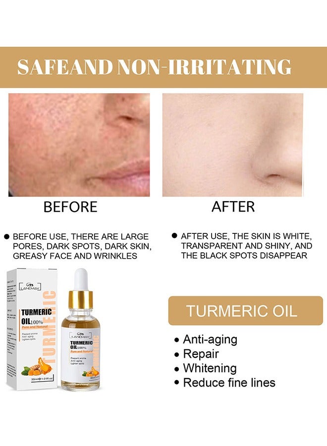 لينماي زيت الكركم ، مصل تصحيح البقع الداكنة للوجه ، يقلل من فرط التصبغ ، مضاد للشيخوخة ، بقع الشيخوخة ، بقع الشمس ، ويحسن لون البشرة للنساء والرجال من جميع أنواع البشرة 30 مل - Image 3