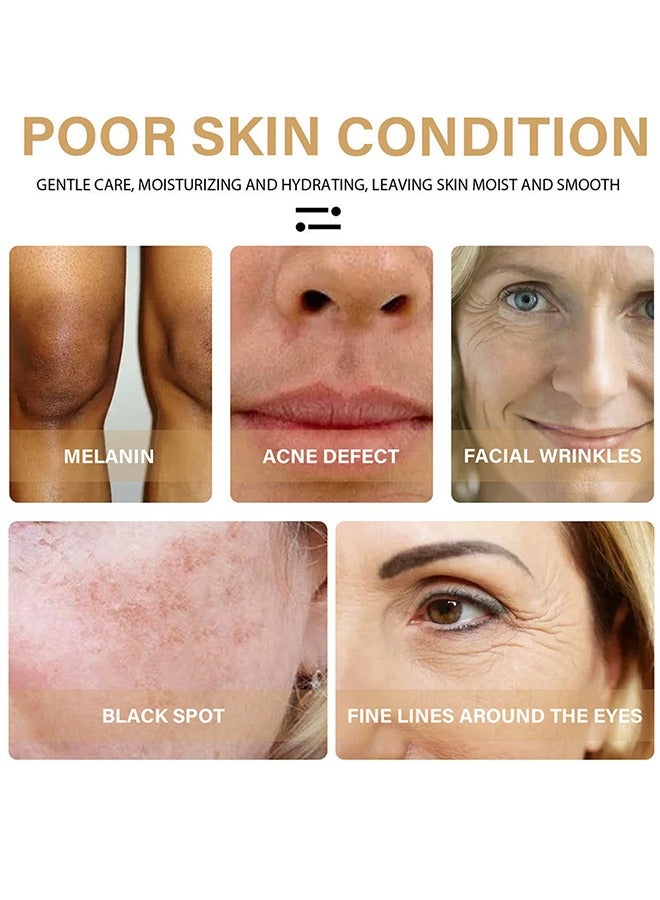 لينماي زيت الكركم ، مصل تصحيح البقع الداكنة للوجه ، يقلل من فرط التصبغ ، مضاد للشيخوخة ، بقع الشيخوخة ، بقع الشمس ، ويحسن لون البشرة للنساء والرجال من جميع أنواع البشرة 30 مل - Image 4