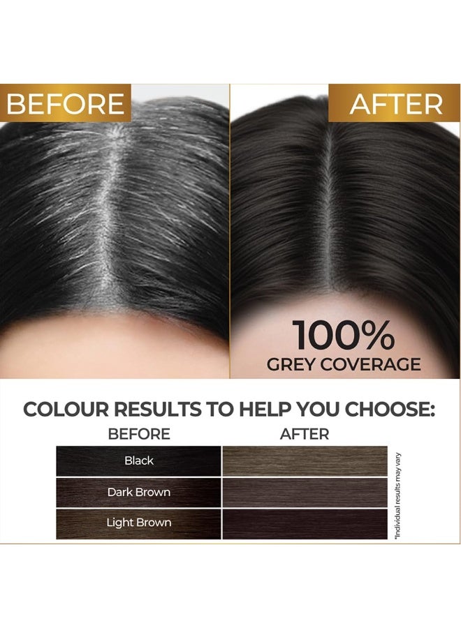 ستريكس جل صبغة شعر ستريكس للنساء والرجال، بني غامق ٣، ١٥٠ مل | لون شعر بني غامق | تغطية ١٠٠٪ للشعر الرمادي | لون شعر يدوم طويلًا، سهل الاستخدام | لون شعر خالٍ من الأمونيا، يدوم حتى ٢٠ غسلة - Image 5
