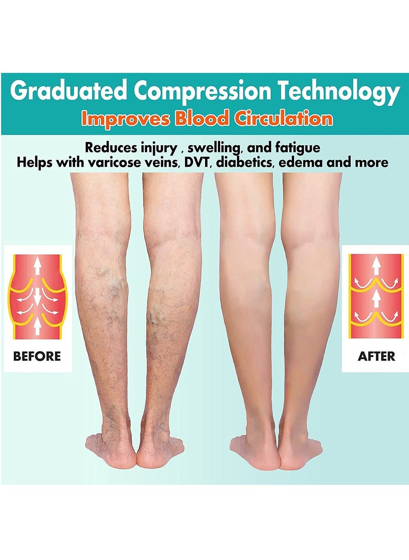 Generic 2 Pairs Compression Socks Open Toe Compression Stockings Knee High Socks with Zipper Compression Pantyhose 15-20mmHg for Improves Blood Circulation Prevents Leg Swelling (Beige)  - Image 3