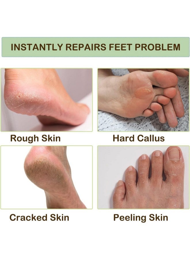 DHYANI DHYANI Spa Moisturizing Gel Socks for Dry Feet and Ankles - Helps Repair Cracked Skincare Gel Therapy and Softens Feet (1 Pair) - Image 5