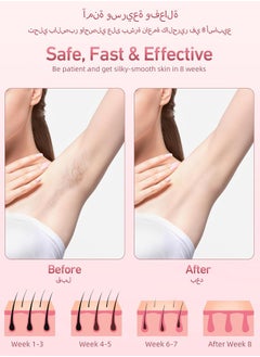 spa luxetique Ice Compress Laser Hair Removal Device Pink  - Image 4
