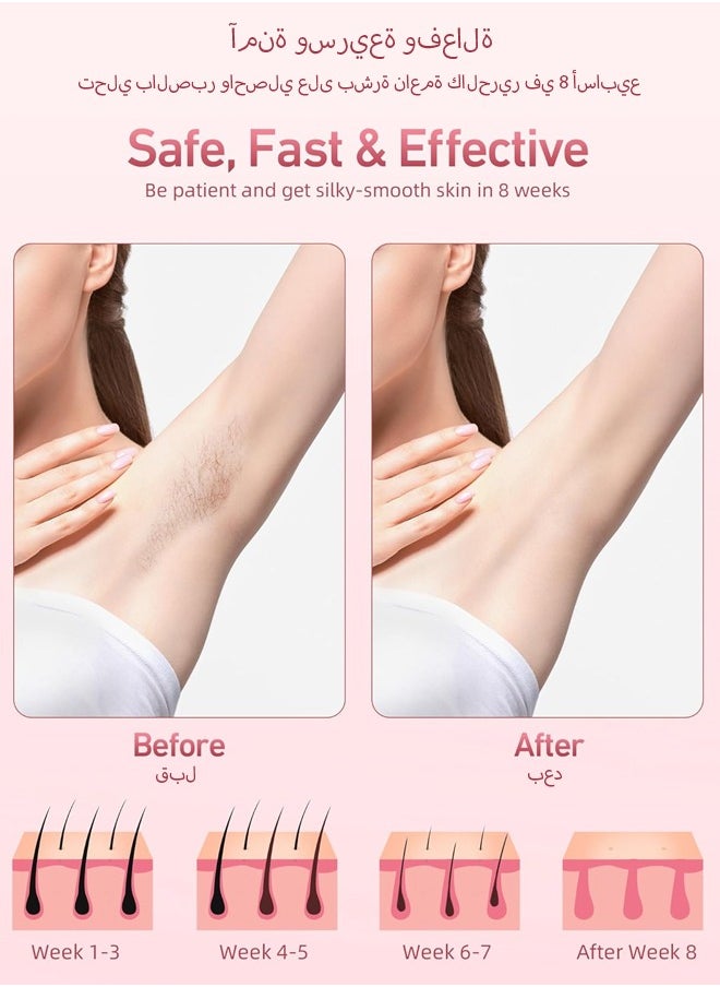spa luxetique Ice Compress Laser Hair Removal Device Pink  - Image 4