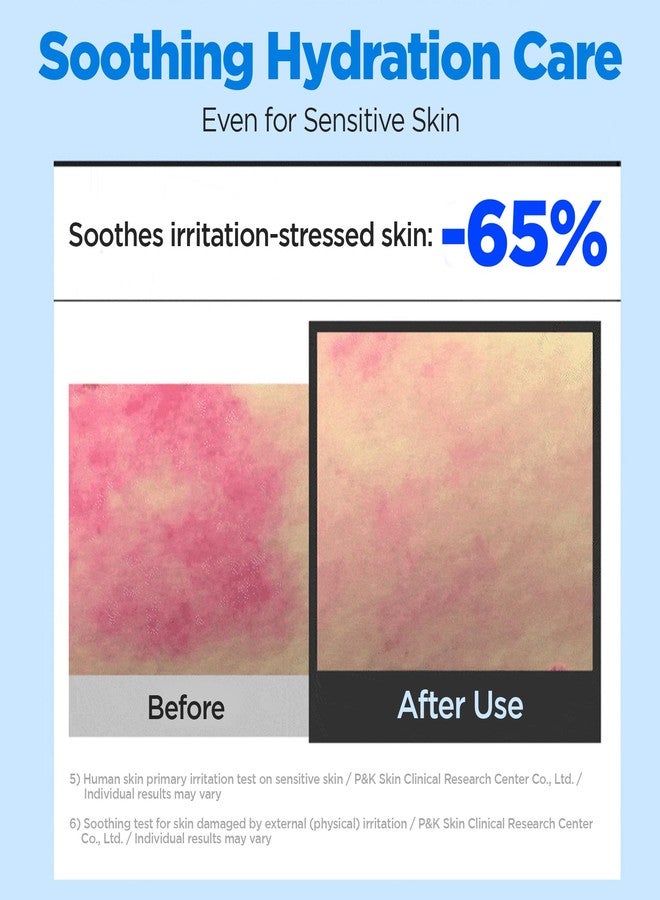 ويليدج كريم ويلاج المهدئ بحمض الهيالورونيك الحقيقي 100، مرطب الوجه الكوري بحمض الهيالورونيك النقي مع PDRN - مرطب للوجه، مضاد للحساسية، 2.7 أونصة. - Image 3