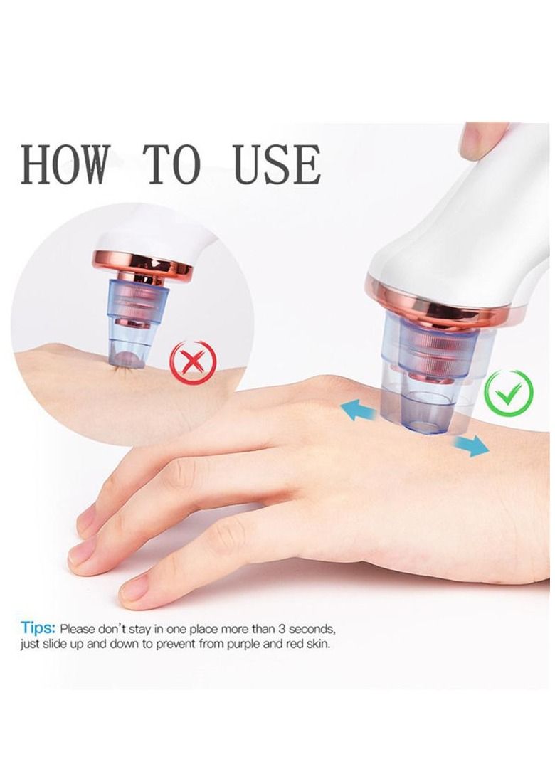 جهاز إزالة الرؤوس السوداء للوجه - Image 4