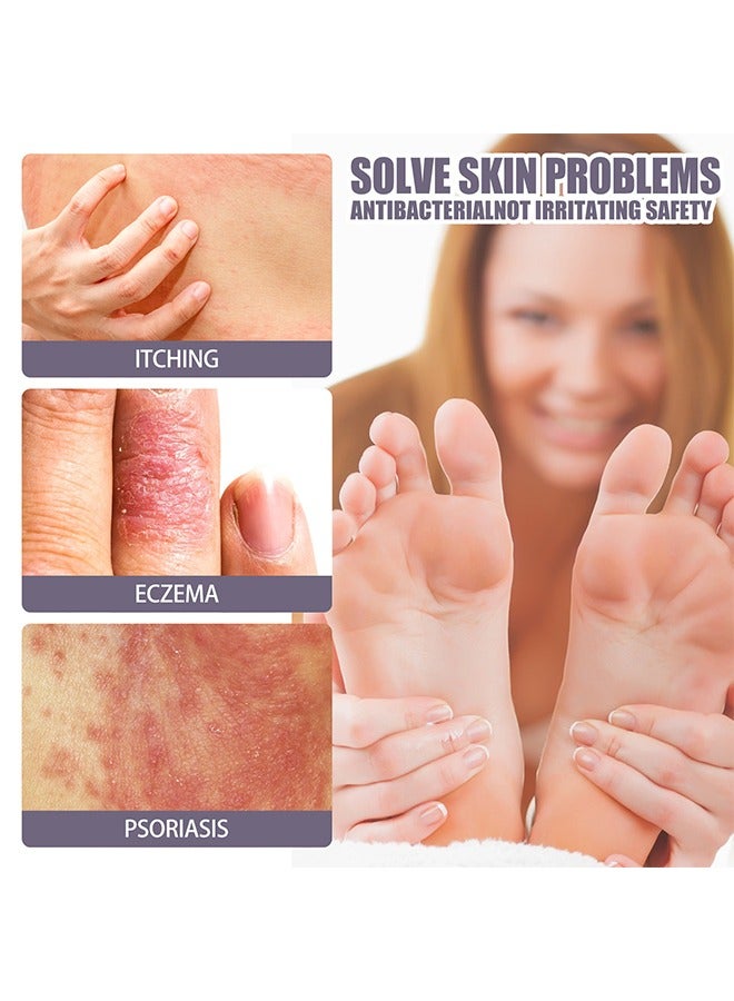 EELHOE Eczema & Psoriasis - Eczema & Psoriasis Atomizing Spray, Hand and Foot Moss Skin Repair, Relieve Itching, Skin care and Jiejia spray, Antibacterialnot Irritating Safety 30ML - Image 5