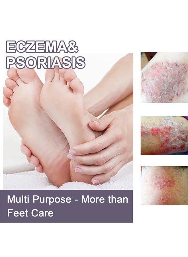 EELHOE Eczema & Psoriasis - Eczema & Psoriasis Atomizing Spray, Hand and Foot Moss Skin Repair, Relieve Itching, Skin care and Jiejia spray, Antibacterialnot Irritating Safety 30ML - Image 2