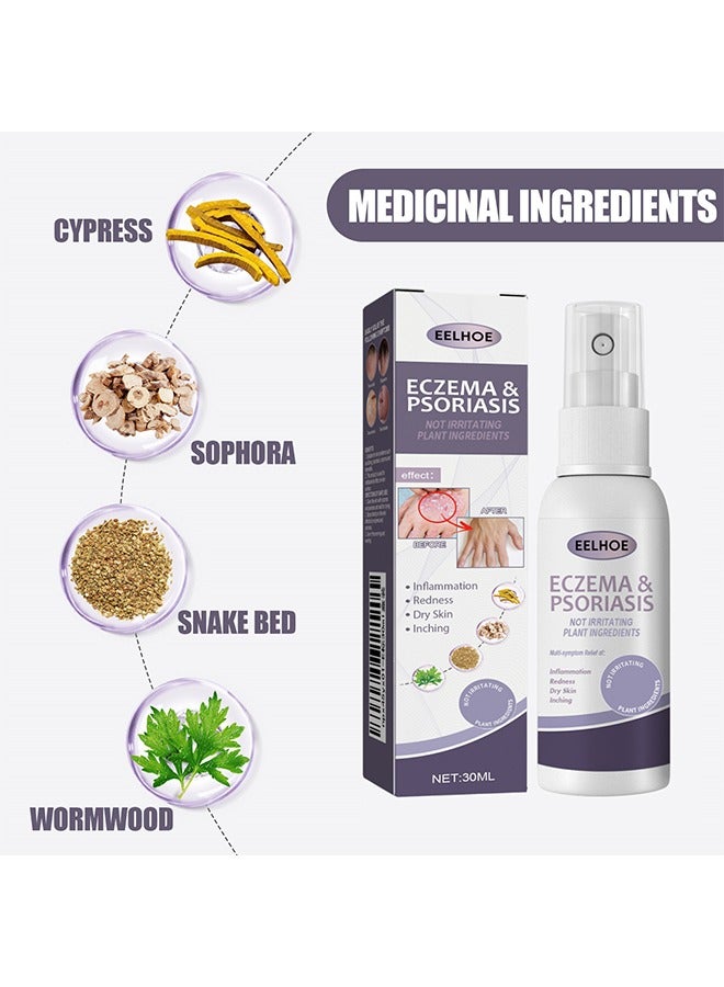 EELHOE Eczema & Psoriasis - Eczema & Psoriasis Atomizing Spray, Hand and Foot Moss Skin Repair, Relieve Itching, Skin care and Jiejia spray, Antibacterialnot Irritating Safety 30ML - Image 3