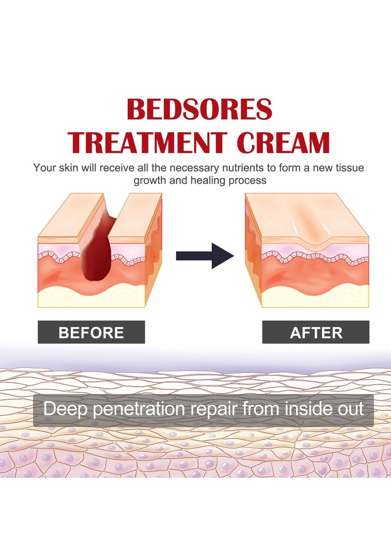 EELHOE Decubitus Repair Cream, Repair Skin Barrier, Moisturize and Hydrate, Prevent Dry Skin, Body Care Cream - Image 2