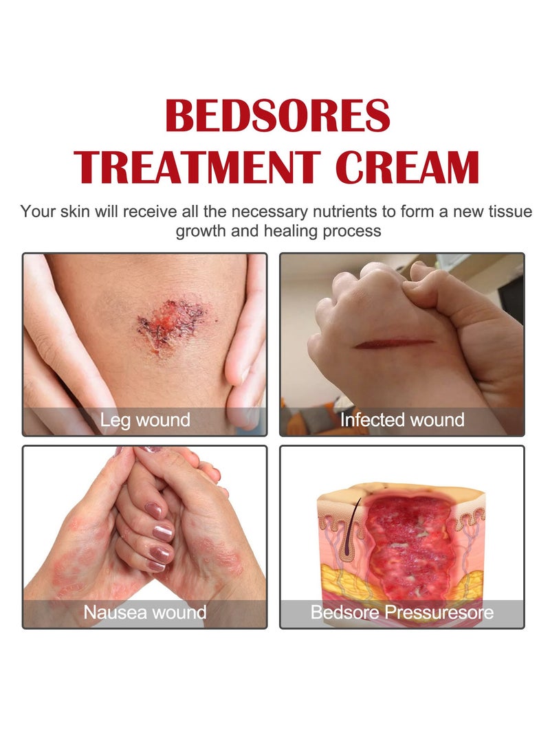 EELHOE Decubitus Repair Cream, Repair Skin Barrier, Moisturize and Hydrate, Prevent Dry Skin, Body Care Cream - Image 3