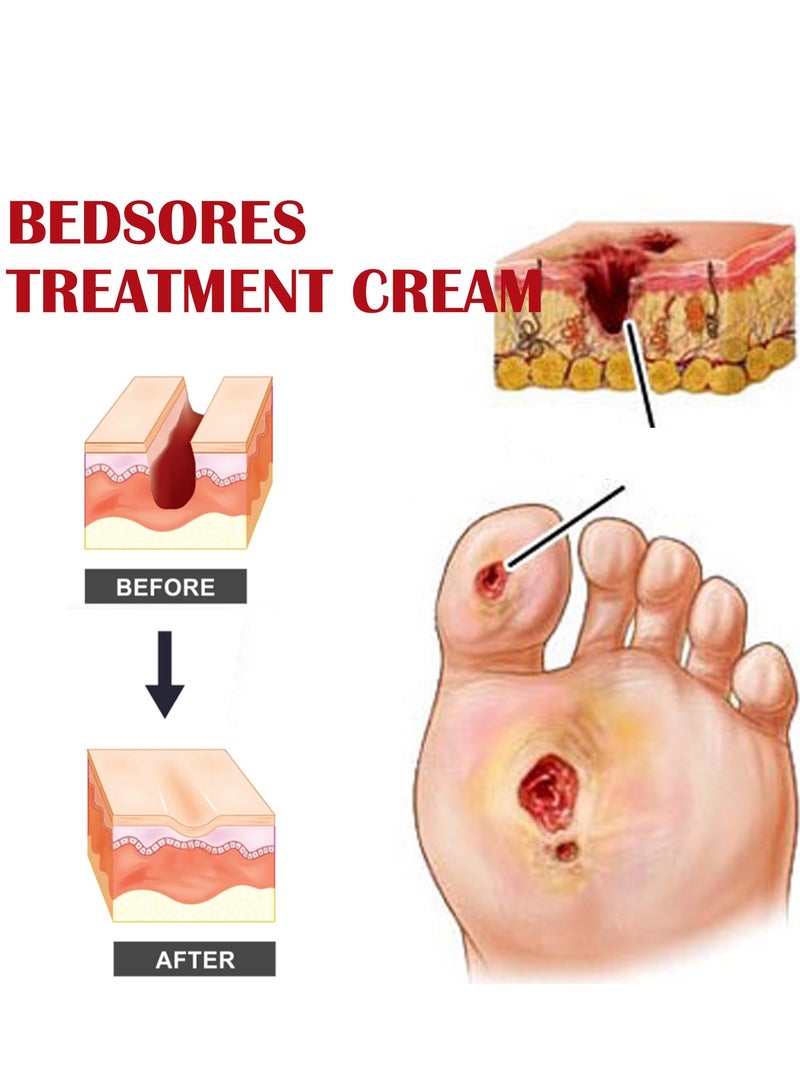 EELHOE Decubitus Repair Cream, Repair Skin Barrier, Moisturize and Hydrate, Prevent Dry Skin, Body Care Cream - Image 5