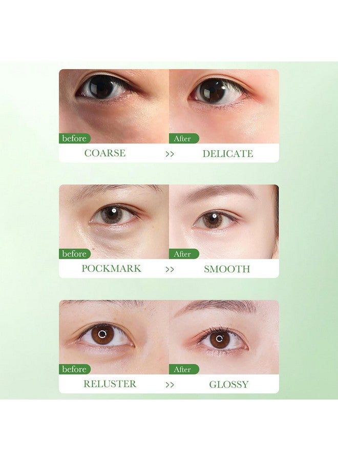 بيو أكوا كريم كينتيللا اسياتيكا المغذي لإصلاح العين ومهدئ للتحكم في الزيت ومضاد لحب الشباب 20 جم / 0.7 أونصة - Image 2