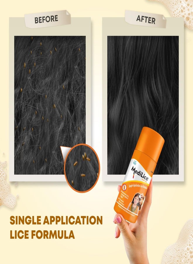 Medilice Cream Wash Single Application Head Lice Formula | Removes Nits, Eggs & Larvae | Prevents Recurrence | Trusted Indian Brand Since 1998 (Pack of 4) - Image 3