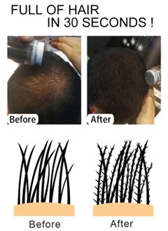 Sevich Hair Building Fibers Keratin Thicker Anti Hairs Loss Concealer Thickening Fiber Powders Growth Sevich 25G  - Image 5