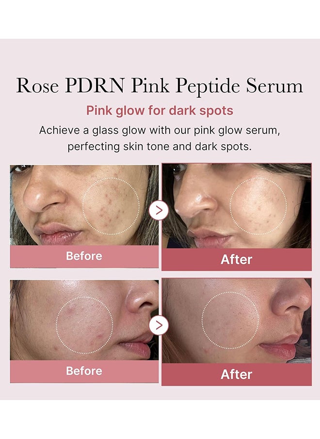 Medicube - Rose PDRN Pink Peptide Serum, 30ml - Image 1