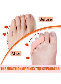 MIKO 2 Piece Pinky Gel Toe Separators, 3-Holes Toe Separators for Overlapping Toe,Toe Straightener Toe Correctors and Protect  - Image 2