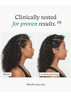 NUTRAFOL Nutrafol Women's Vegan Hair Growth Supplements, Plant-Based, Ages 18-44, Clinically Tested for Visibly Thicker, Stronger Hair, Dermatologist Recommended - 2 Month Supply, 2 Refill Pouches  - Image 4