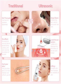 Ru syanl Electric Face Cleaner Blackhead Acne Remover LCD Facial Skin Care Tool  - Image 5