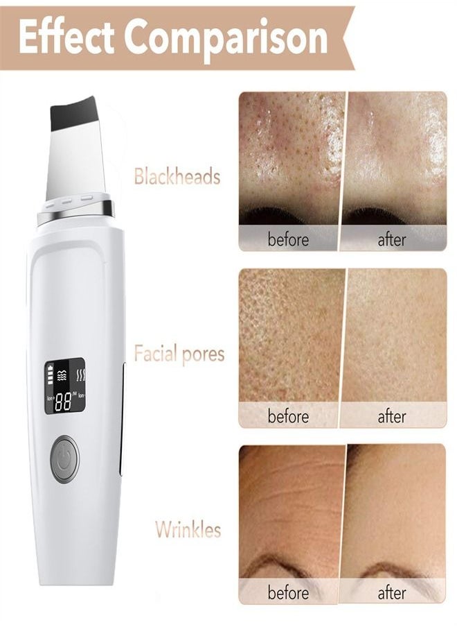Electric Face Cleaner Blackhead Acne Remover LCD Facial Skin Care Tool - https://f.nooncdn.com/p/pzsku/Z419F4AB6E534FE3EFBA6Z/45/_/1681780544/e30e6f62-bbc6-478d-bb25-e88ac4bd156f.jpg?width=original