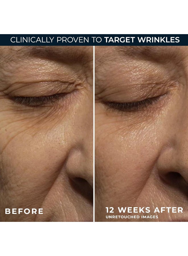 roc retinol correxion deep wrinkle night cream - Image 4