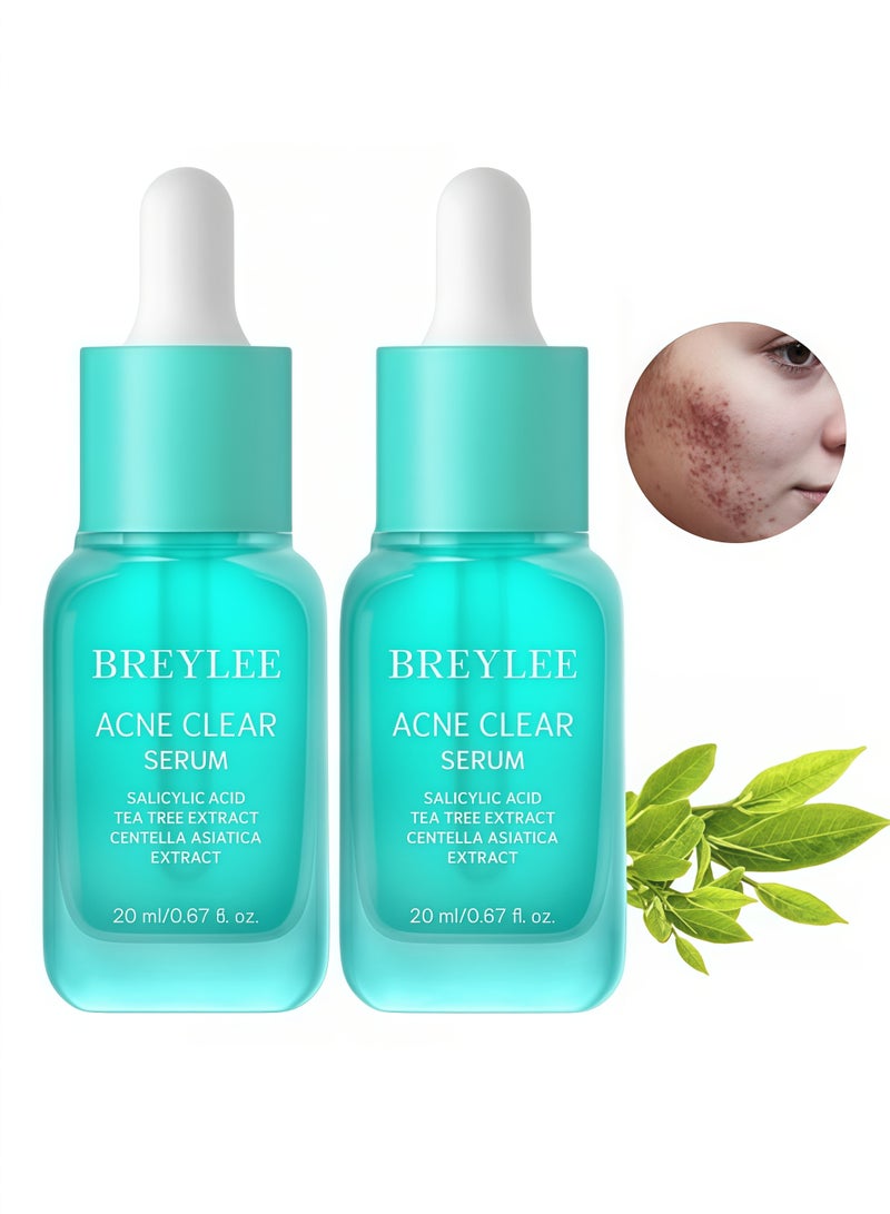 بريلي عبوتان من سيروم زيت شجرة الشاي لعلاج حب الشباب - يزيل حب الشباب، ويخفف البقع، ويهدئ البشرة ويتحكم في إفراز الزيوت 20 مل × 2 - Image 1