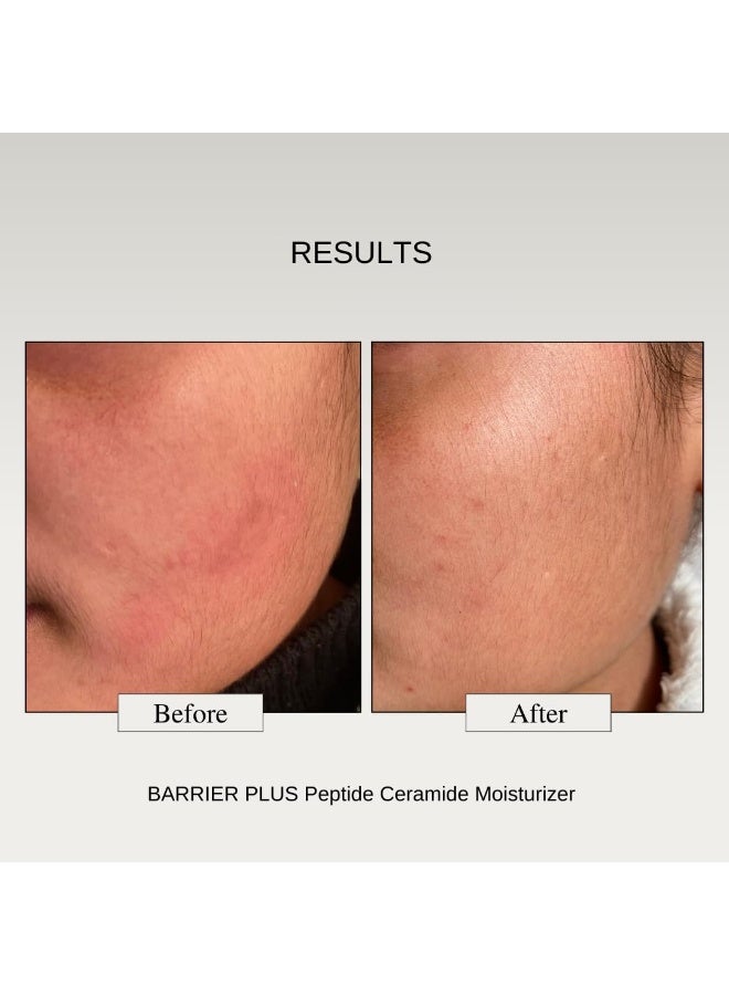 The Formularx Peptide Ceramide Moisturizer - Barrier Plus Nourishing Barrier Repair Moisturizer For Normal, Dry, Compromised, Sensitive skin 50 g - Image 4