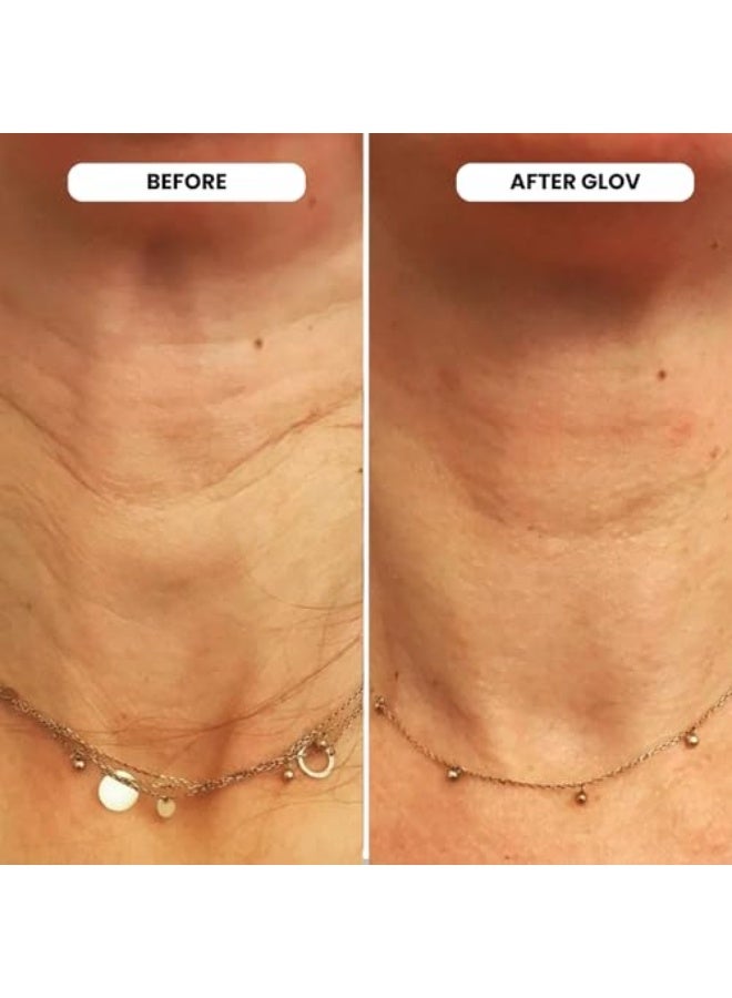 جلوف Glov Beauty، محلول مضاد للشيخوخة يعمل بتقنية الإبر الدقيقة،  نظام التسريب الدقيق - ختم تجميلي للوجه من الذهب عيار 24 قيراط بسمك 0.25 مم مع أمبولات سيروم حمض الهيالورونيك والببتيد - مجموعة ترطيب وتنعيم للوجه والشفاه للاستخدام المنزلي - Image 3