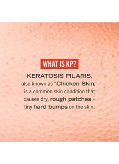 Kp Bump Eraser Body Scrub Exfoliant For Keratosis Pilaris With 10% Aha  8 Oz - pzsku/Z41BD1BCA34D753D7407DZ/45/_/1690174649/86ea85fe-eca4-45bf-8285-80b4d47cf274