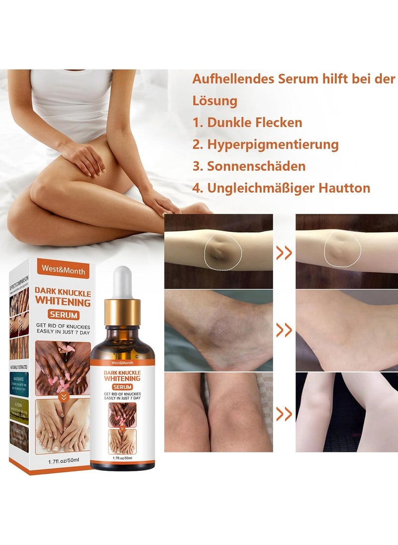 West&Month Brightening Essence | Dark Spot Cream Body Whitening Lotion - Common Degradation Essence for Removing Dark Knuckles, Fingers, Elbows and Knees, Whitening  - Image 3