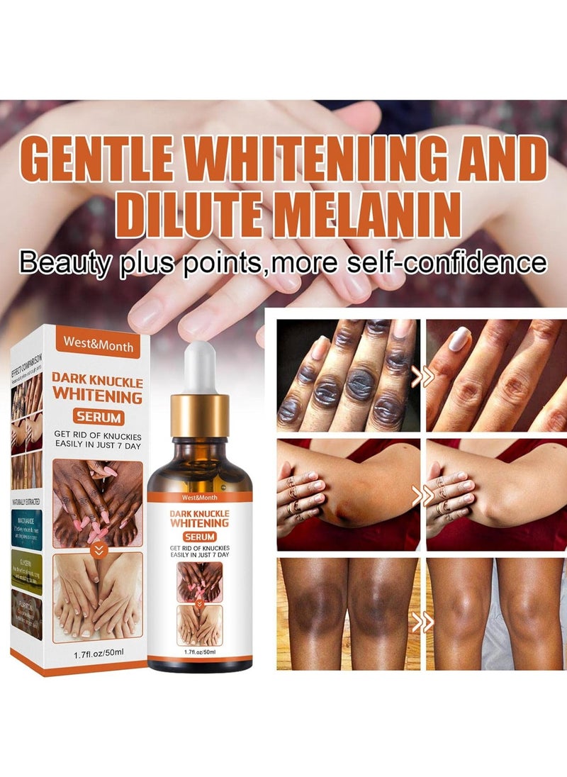 West&Month Brightening Essence | Dark Spot Cream Body Whitening Lotion - Common Degradation Essence for Removing Dark Knuckles, Fingers, Elbows and Knees, Whitening  - Image 4