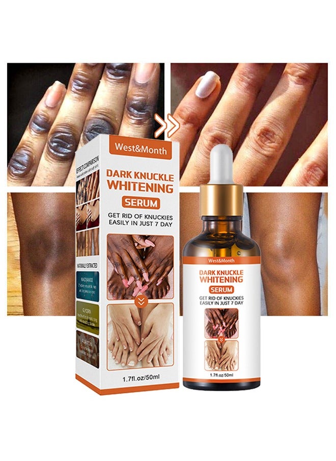 West&Month Dark knuckle Whitening Serum,7 days Treatment for Dark Spots in Hand and Feet Knuckles Exfoliating Improves Dullness Powerful Whitening Effect for Men and Women 50ml  - Image 1
