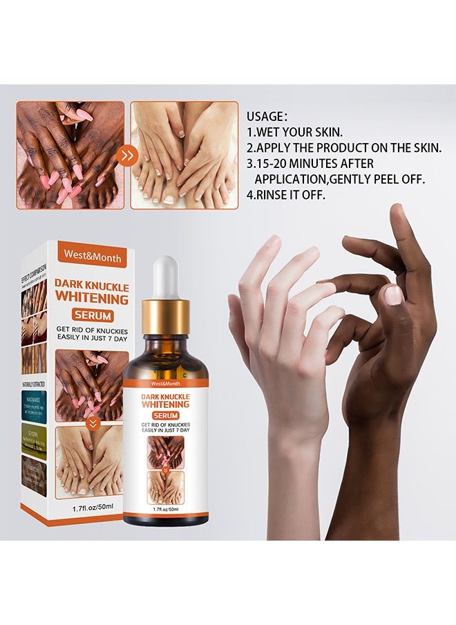 West&Month Dark knuckle Whitening Serum,7 days Treatment for Dark Spots in Hand and Feet Knuckles Exfoliating Improves Dullness Powerful Whitening Effect for Men and Women 50ml  - Image 4