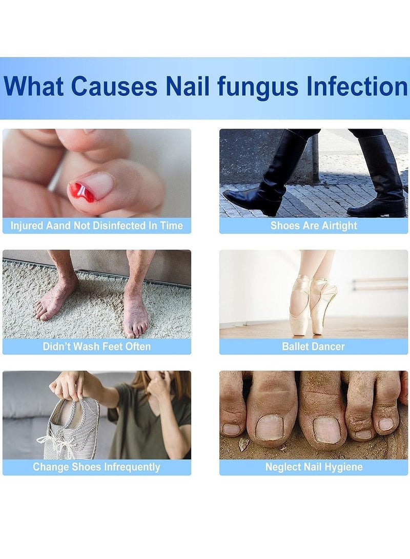 Sefudun 60Pcs Nail Repair Patches Toenail Fungus Treatment Nail Repair Treatment Extra Strength Restores Appearance of Discolored or Damaged Nails - Image 4