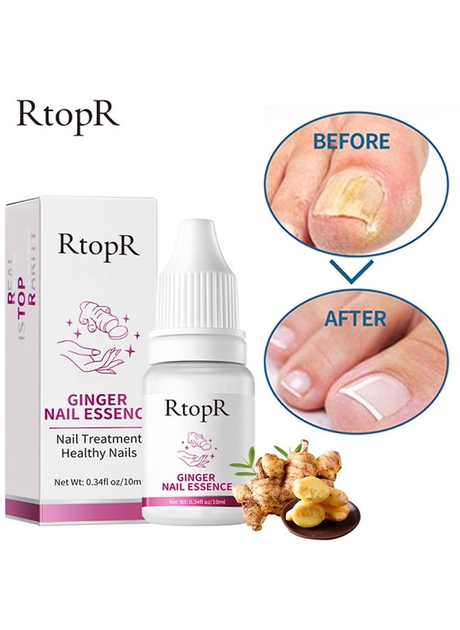 RtopR - Ginger Nail Essence - Has Antifungal And Antibacterial Properties, Relieves Nail Infections, And Promotes Nail Healing, Nail Treatment Healthy Nails Repair Essence 10ml - Image 1