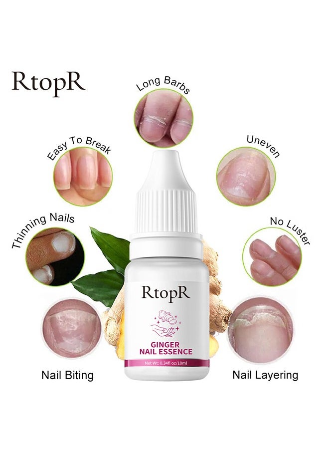 RtopR - Ginger Nail Essence - Has Antifungal And Antibacterial Properties, Relieves Nail Infections, And Promotes Nail Healing, Nail Treatment Healthy Nails Repair Essence 10ml - Image 1