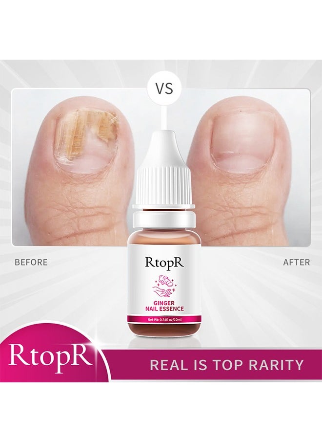 RtopR - Ginger Nail Essence - Has Antifungal And Antibacterial Properties, Relieves Nail Infections, And Promotes Nail Healing, Nail Treatment Healthy Nails Repair Essence 10ml - Image 1