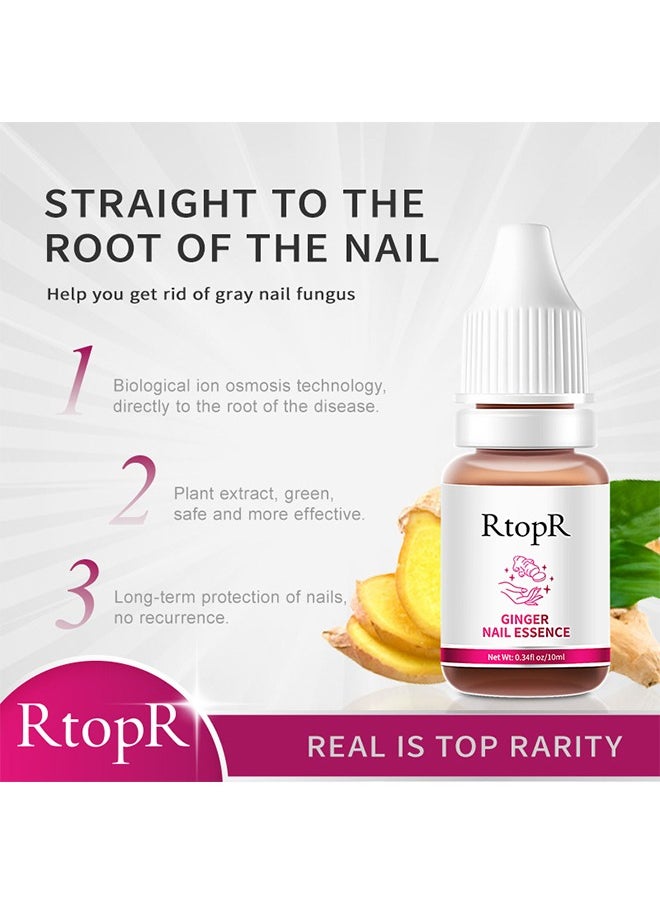 RtopR - Ginger Nail Essence - Has Antifungal And Antibacterial Properties, Relieves Nail Infections, And Promotes Nail Healing, Nail Treatment Healthy Nails Repair Essence 10ml - Image 1