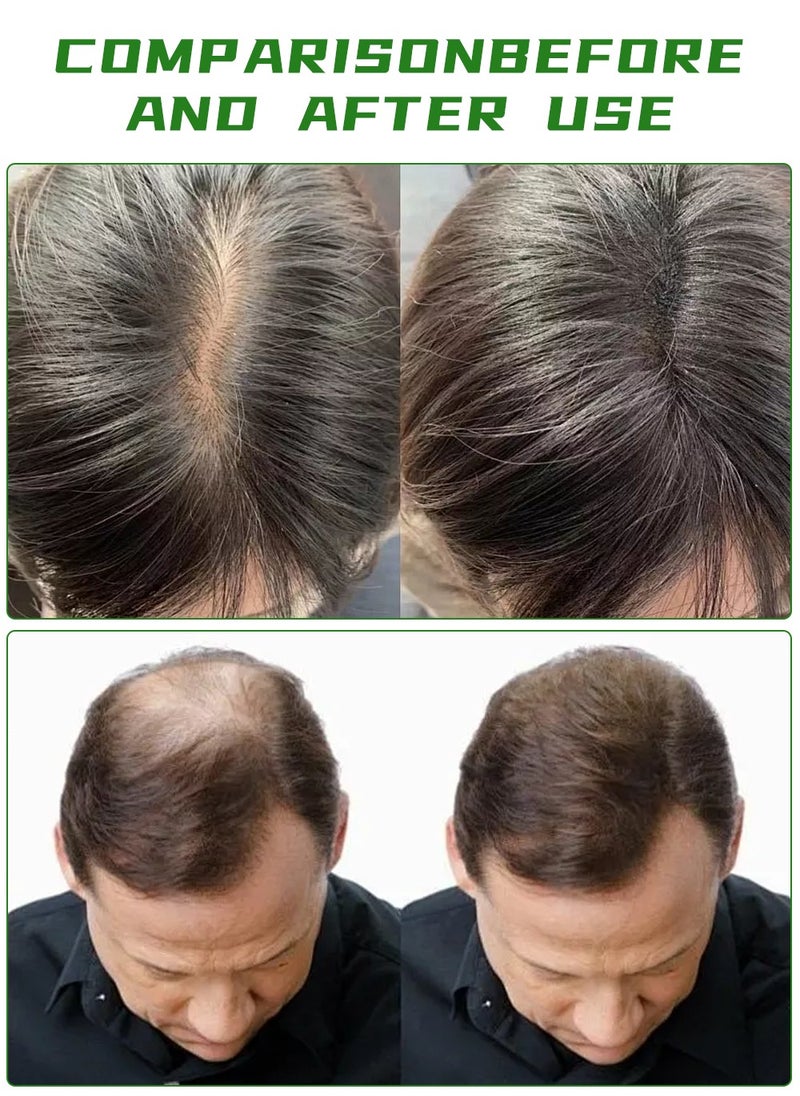 EELHOE - Rosemary Essential Oil For Hair Growth Skin Care,30ml - Image 1