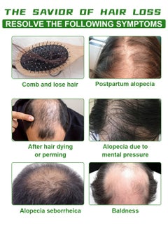 EELHOE Rosemary Essential Oil For Hair Growth Skin Care,30ml  - Image 5