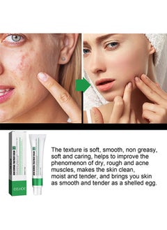 EELHOE Acne Removal Treatment Cream, Acne Removal Acne Pimple Repair Cream, Acne Spot Treatment for Face & Acne Dots, Natural Cystic Acne Treatment Suitable for Oily And Acne Prone Skin, Oil Control Acne Cre  - Image 2
