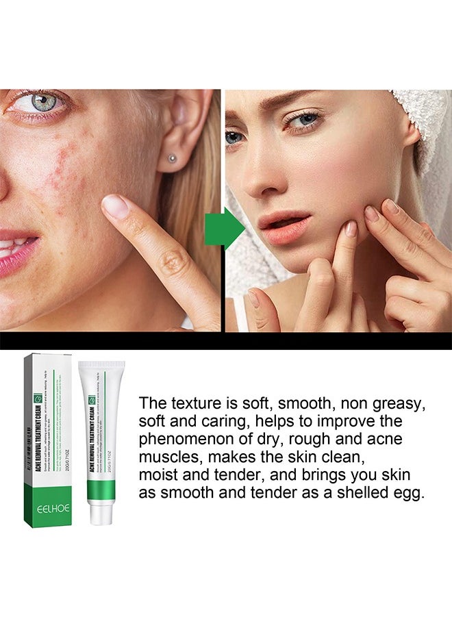 EELHOE Acne Removal Treatment Cream, Acne Removal Acne Pimple Repair Cream, Acne Spot Treatment for Face & Acne Dots, Natural Cystic Acne Treatment Suitable for Oily And Acne Prone Skin, Oil Control Acne Cre  - Image 2