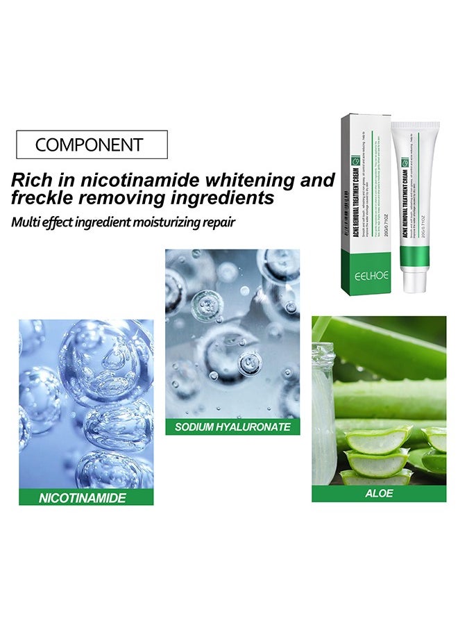 EELHOE Acne Removal Treatment Cream, Acne Removal Acne Pimple Repair Cream, Acne Spot Treatment for Face & Acne Dots, Natural Cystic Acne Treatment Suitable for Oily And Acne Prone Skin, Oil Control Acne Cre  - Image 3