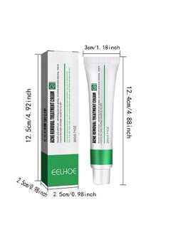 EELHOE Acne Removal Treatment Cream, Acne Removal Acne Pimple Repair Cream, Acne Spot Treatment for Face & Acne Dots, Natural Cystic Acne Treatment Suitable for Oily And Acne Prone Skin, Oil Control Acne Cre  - Image 5
