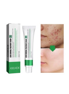 EELHOE Acne Removal Treatment Cream, Acne Removal Acne Pimple Repair Cream, Acne Spot Treatment for Face & Acne Dots, Natural Cystic Acne Treatment Suitable for Oily And Acne Prone Skin, Oil Control Acne Cre  - Image 1